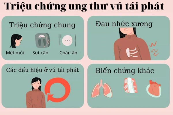 Điều trị, theo dõi ung thư vú thường xuyên để phòng ngừa tái phát.webp